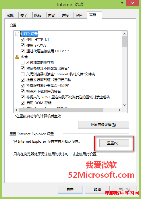 ����IE������ķ������裨��IE11Ϊ����